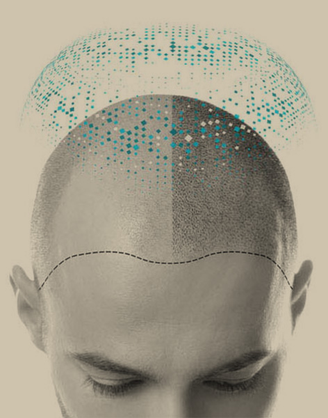 Tricopigmentation Toulouse