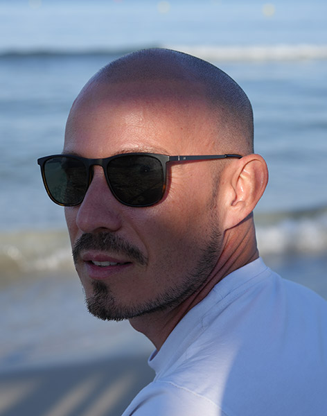 Tricopigmentation Toulouse